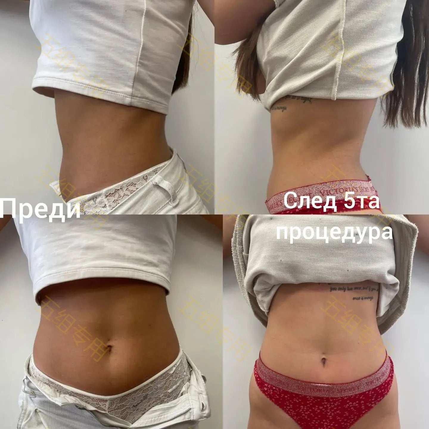 Myoslim EMS Body Sculpt Machine RF Vacuum Roller Slimming