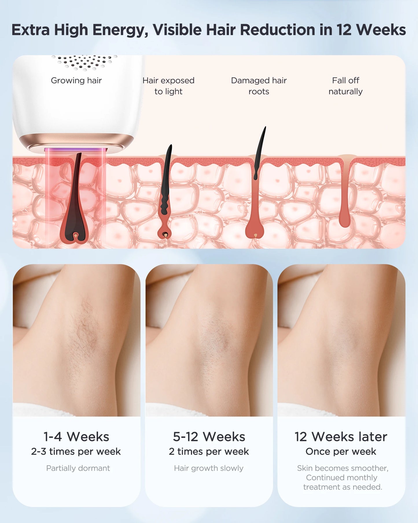 Innza IPL Hair Removal Device, Painless Permanent for Men and Women